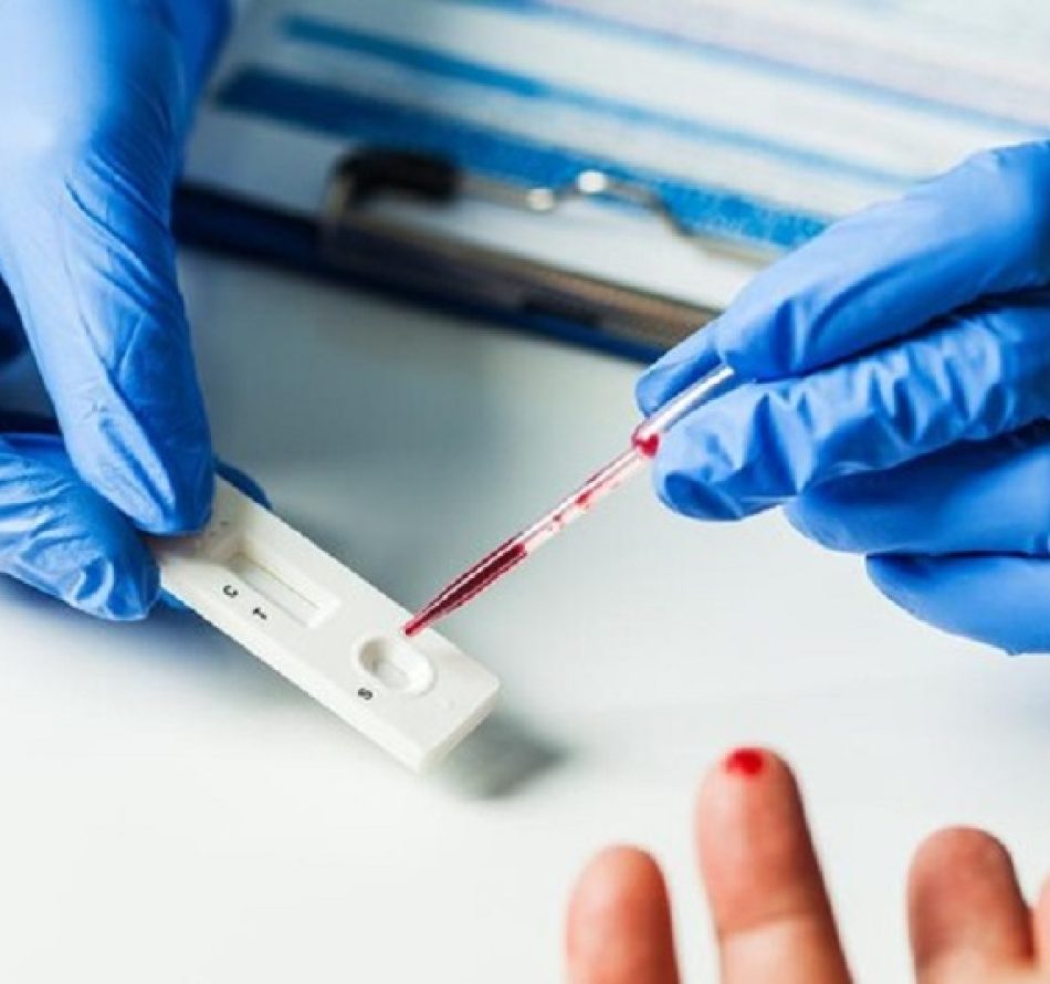 Antisipasi Klaster Perkantoran, UGM Gelar Rapid test Covid-19 Bagi Pegawai