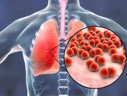 Cegah Pneumonia dengan Perilaku Hidup Bersih dan Sehat