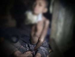Ais (4) Anak Mamberamo Raya Menderita Penyakit Misterius